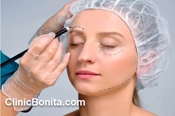 ماندگاری لیفت شقیقه با جراحی چقدر است؟