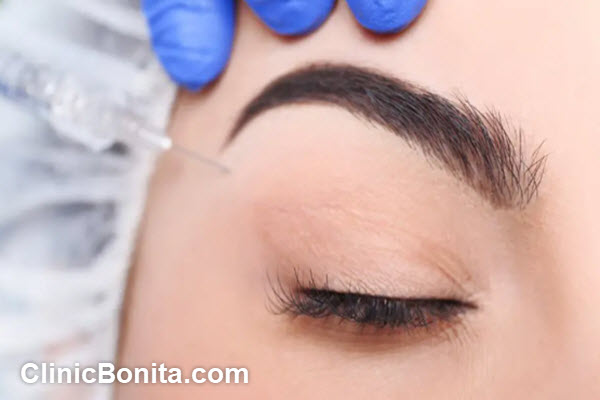 نکات مهم قبل و بعد از تزریق بوتاکس