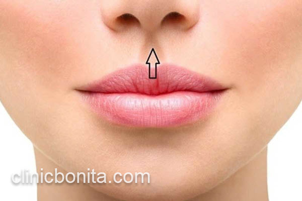 مرکز معتبر سانترال لب طبیعی | کلینیک بنیتای اصفهان