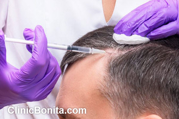 عوامل موثر بر اثربخشی پی آر پی مو