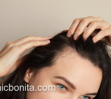 کاشت مو برای پیشانی بانوان | کلینیک بنیتای اصفهان