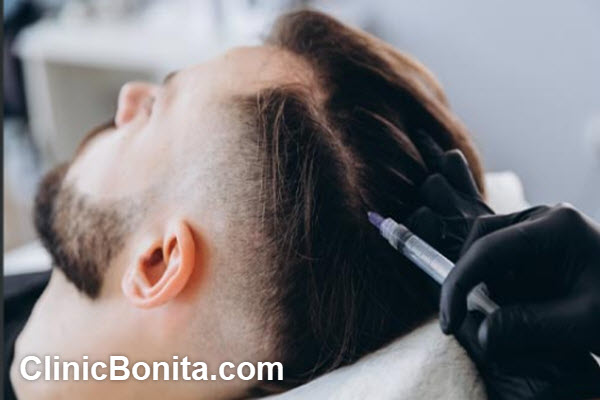 قیمت مزوتراپی مو در سال 1404