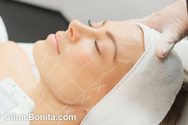 بهترین مرکز انجام هایفوتراپی در اصفهان