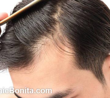 پی آر پی مو چند درصد جواب میده؟