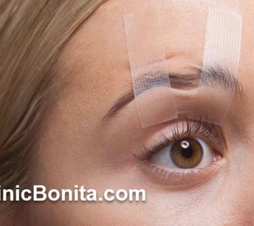 هزینه بلفاروپلاستی بدون جراحی چقدر است؟