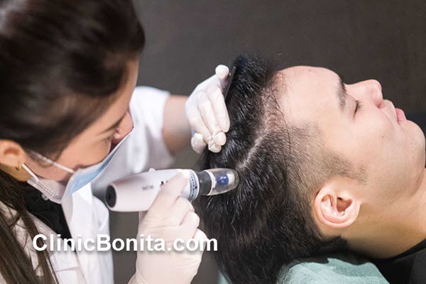 بهترین زمان برای تزریق مزوتراپی مو