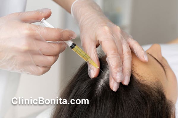 مزوتراپی چیست؟ | اصفهان