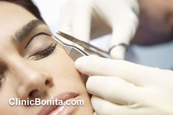 هزینه و عوامل مؤثر بر قیمت بلفاروپلاستی در اصفهان