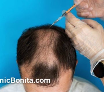 سن مناسب برای مزوتراپی مو چه زمانی است؟