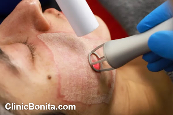 مقایسه با سایر روش های درمانی