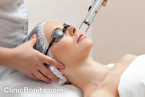 مزایای لیزر co2 فرکشنال برای منافذ باز پوست