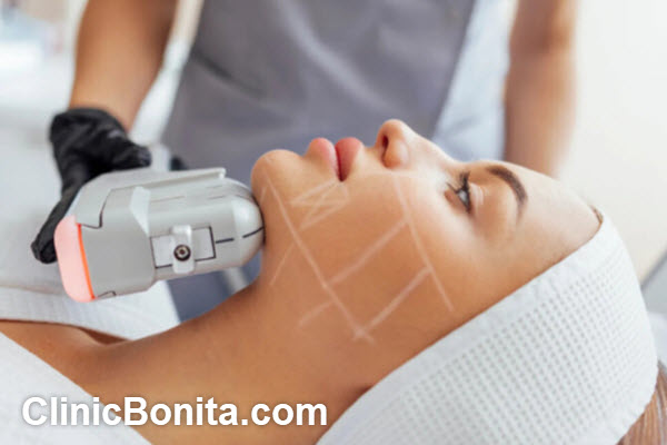 مزایای انجام هایفوتراپی در مراکز معتبر