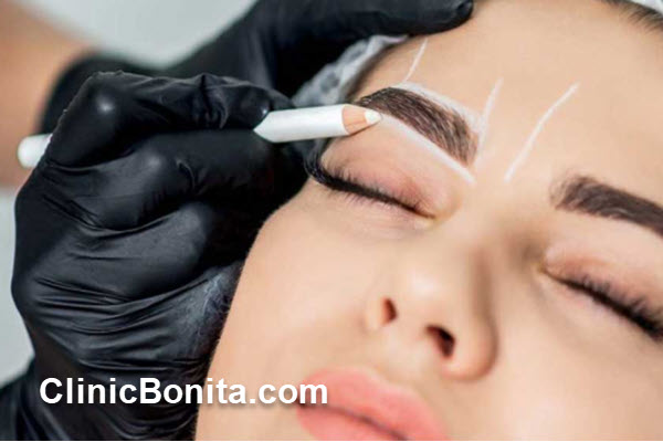 کاشت ابرو بدون جراحی چیست؟