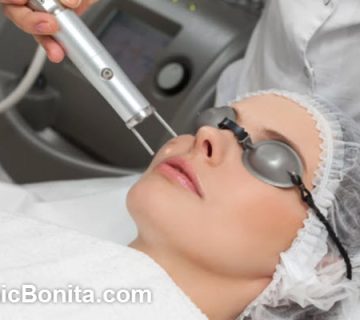 لیزر co2 فرکشنال برای منافذ باز پوست