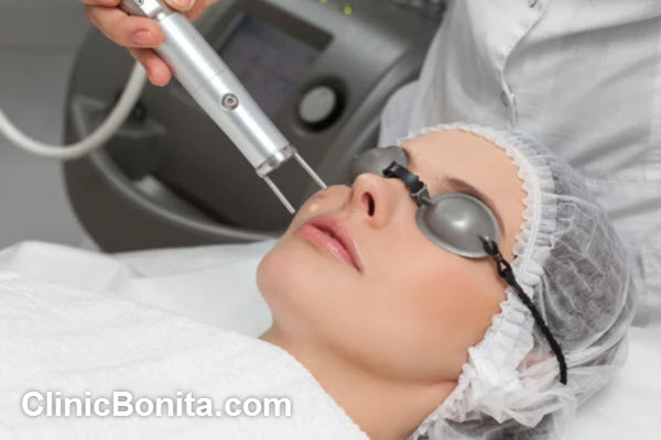 لیزر co2 فرکشنال برای منافذ باز پوست