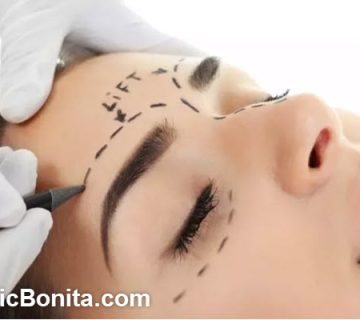 بهترین نقاط تزریق بوتاکس