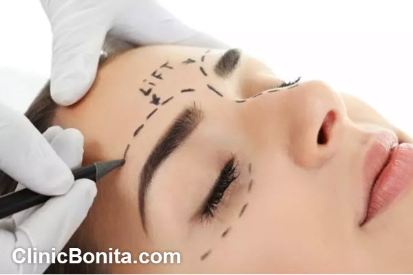 بهترین نقاط تزریق بوتاکس