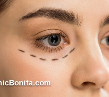 بهترین سن برای عمل بلفاروپلاستی