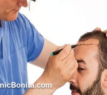 قیمت کاشت هر تار مو در اصفهان