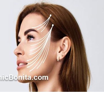 هزینه لیفت شقیقه در سال 1404