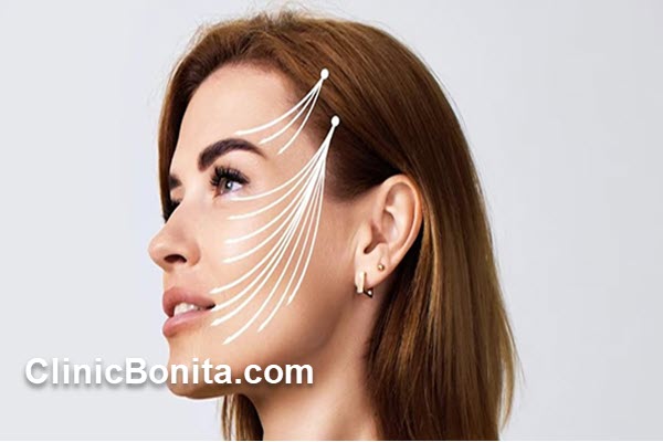 هزینه لیفت شقیقه در سال 1404