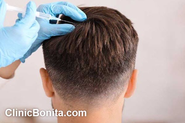 مزایای مزوتراپی مو در سنین مختلف