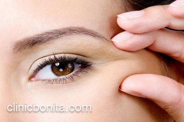 هزینه و قیمت لیفت شقیقه با جراحی | کلینیک بنیتای اصفهان