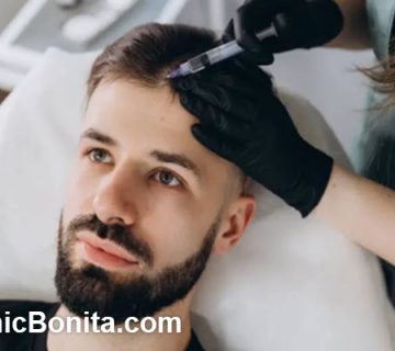 بهترین زمان انجام مزوتراپی مو