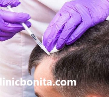 بهترین مرکز تزریق فیلر مو در اصفهان