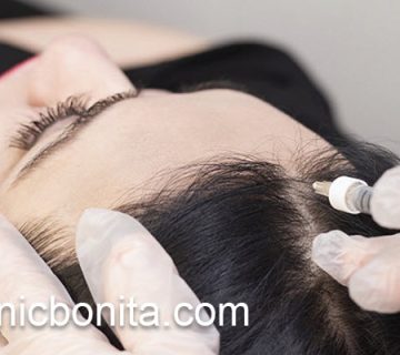 مرکز تخصصی کاشت مو در اصفهان