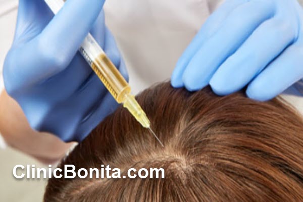 پی آر پی مو چیست و چگونه عمل میکند؟