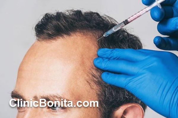 چه افرادی بهترین کاندید برای PRP هستند؟