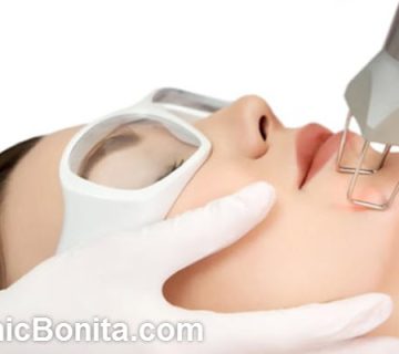 لیزر فرکشنال چند جلسه است؟