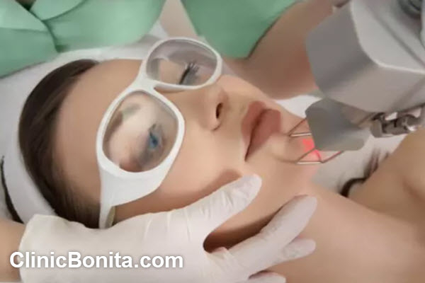 عوامل موثر برای دوام نتایج لیزر فرکشنال
