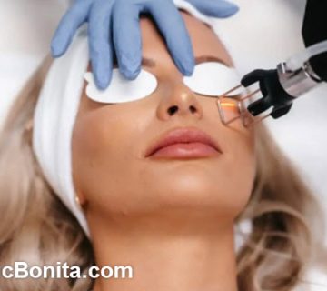 ماندگاری لیزر فرکشنال co2 چقدر است؟
