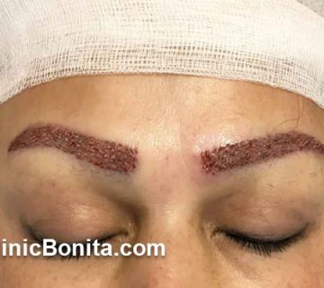 بهترین کاشت ابرو طبیعی ویژه ساکنین اصفهان