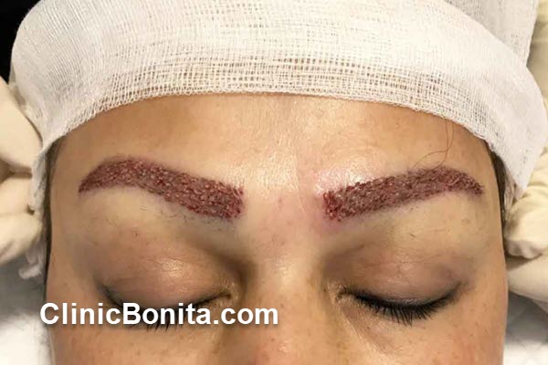بهترین کاشت ابرو طبیعی ویژه ساکنین اصفهان