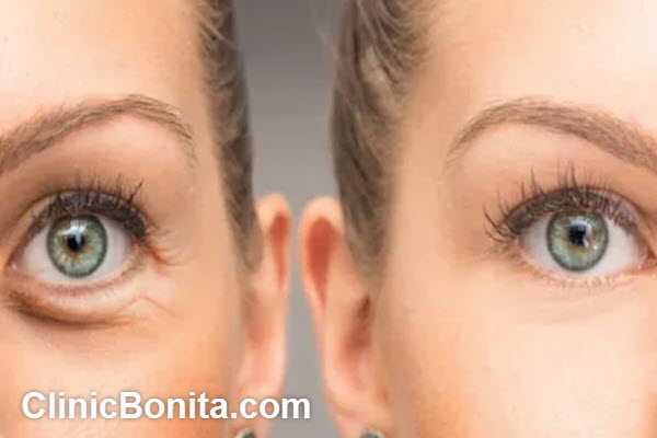 بهترین کلینیک تزریق مزوژل در اصفهان